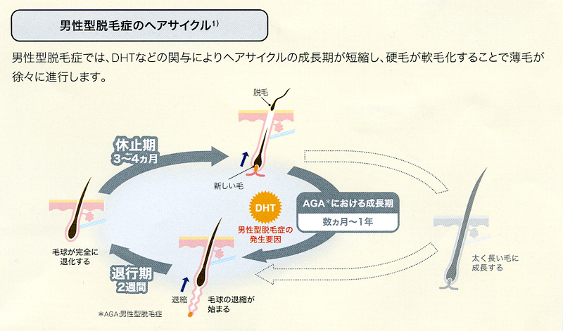 男性型脱毛症のヘアサイクル