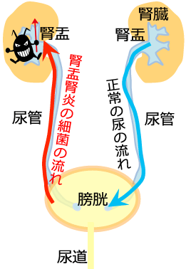 膀胱炎 腎盂腎炎 阿佐谷すずき診療所