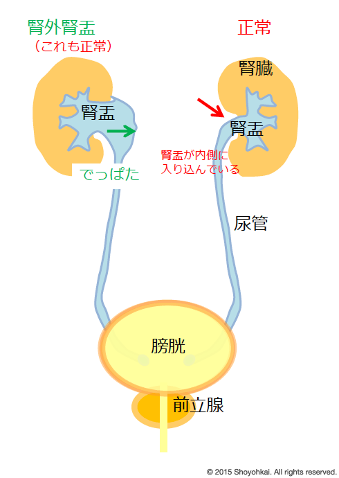 その他の腎臓疾患 阿佐谷すずき診療所