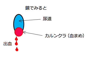 女性泌尿器科 阿佐谷すずき診療所